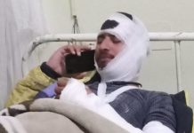 पुलिस की जांच में खुलासा यूकेडी प्रत्याशी ने खुद ही रचा स्वयं पर हमले का प्रपंच , प्रत्याशी ने की सीबीआई जांच की मांग