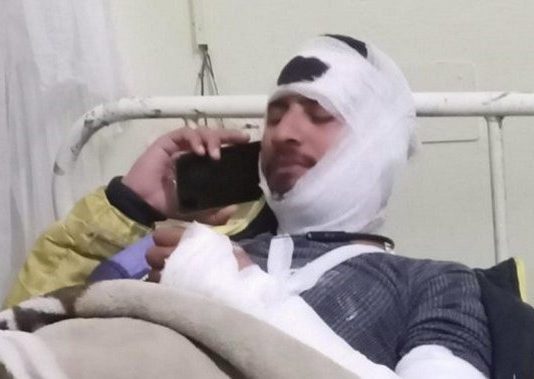 पुलिस की जांच में खुलासा यूकेडी प्रत्याशी ने खुद ही रचा स्वयं पर हमले का प्रपंच , प्रत्याशी ने की सीबीआई जांच की मांग