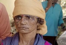 सास और ननद ने क्रूरता से महिला को गर्म तवे से जलाया, विरोध करने पर बच्चों से की मारपीट