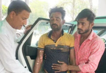 तारों की चपेट में आने से बुरी तरह झुलसा लाइनमैन