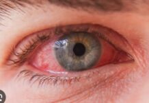 डेंगू के बाद आई फ्लू संक्रमण के बड़े मामले